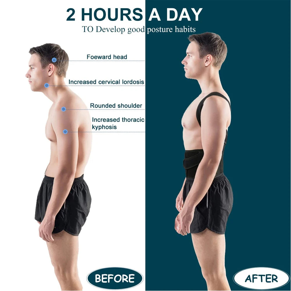 Backuro™ Advanced Back Posture Corrector