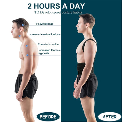Backuro™ Advanced Back Posture Corrector